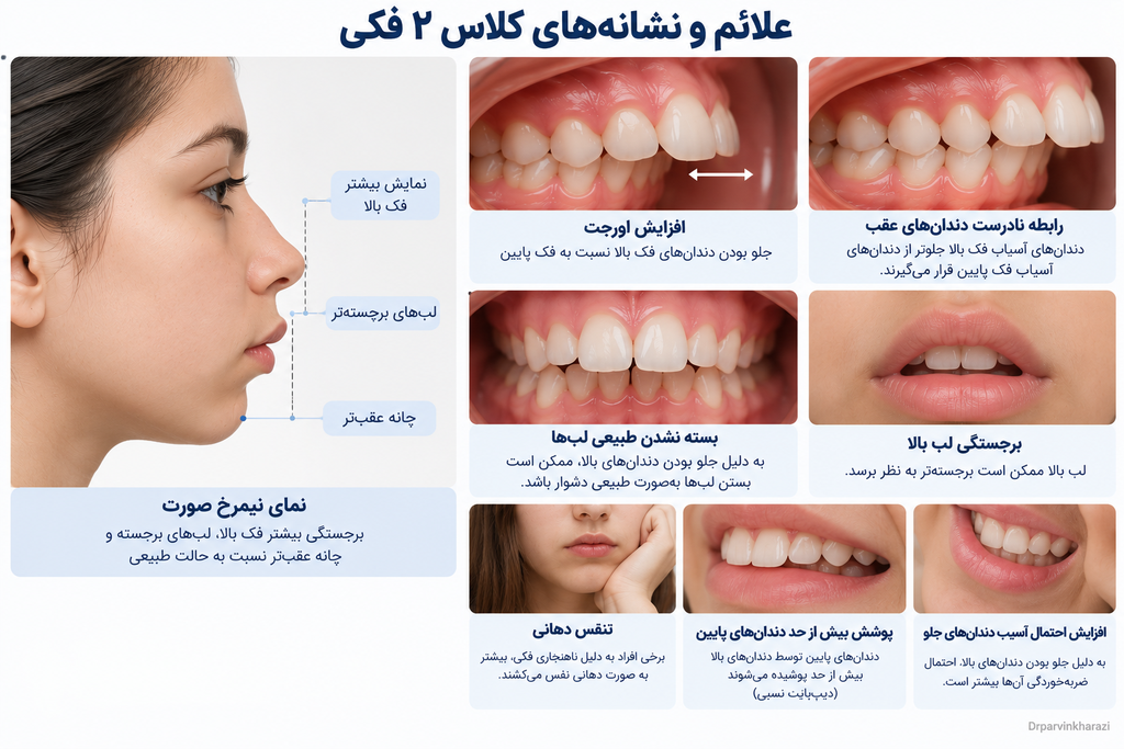 درمان ناهنجاری کلاس ۲ فکی با ارتودنسی ثابت و کش‌های بین فکی برای اصلاح رابطه دندان‌ها