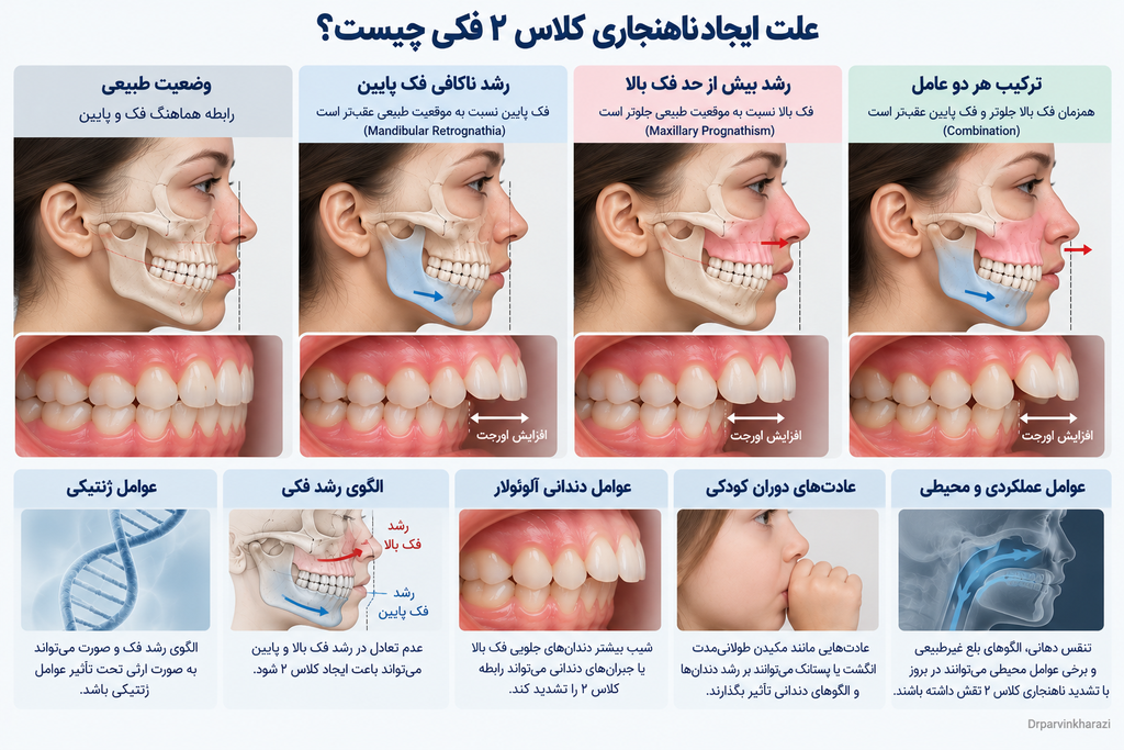 روش‌های درمان ناهنجاری کلاس ۲ فکی با ارتودنسی ثابت، براکت و کش‌های بین‌فکی